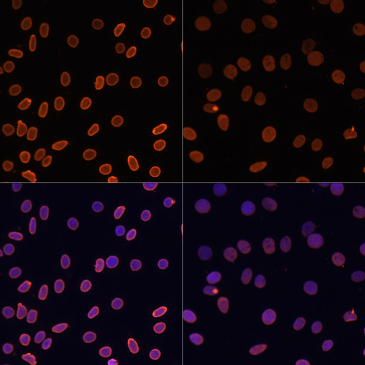 Immunofluorescence analysis of C6 cells using Acetyl-Histone H2A-K5 Polyclonal Antibody at dilution of  1:100.C6 cells were treated by TSA (1 uM) at 37℃ for 18 hours. Blue: DAPI for nuclear staining.