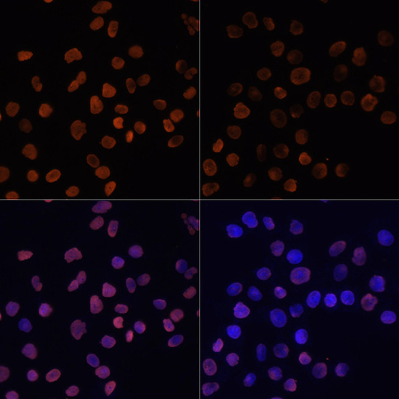Immunofluorescence analysis of HeLa cells using Acetyl-Histone H2A-K5 Polyclonal Antibody at dilution of  1:100.HeLa cells were treated by TSA (1 uM) at 37℃ for 18 hours. Blue: DAPI for nuclear staining.