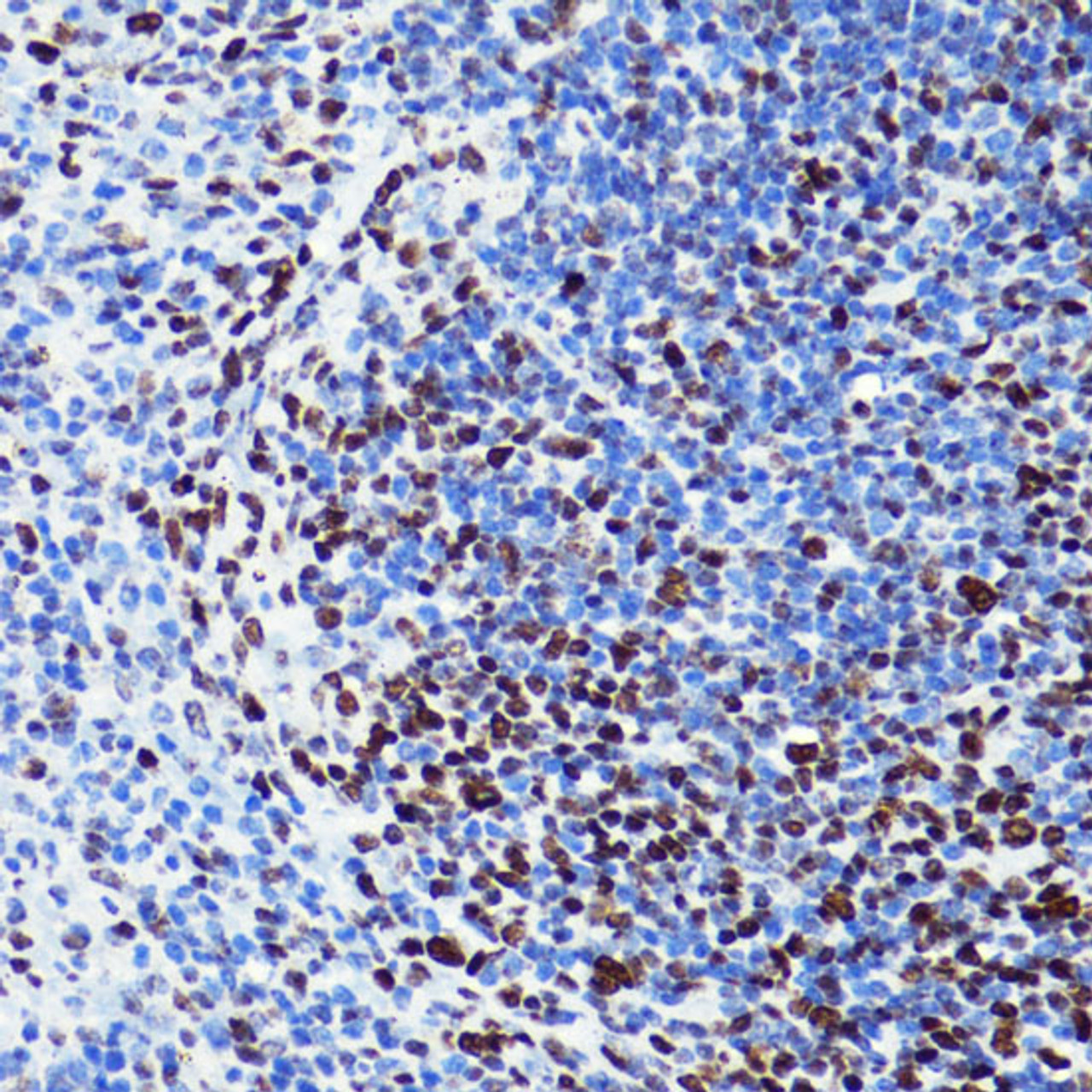 Immunohistochemistry of paraffin-embedded Mouse spleen using Acetyl-Histone H2B-K5 Polyclonal Antibody at dilution of  1:100 (40x lens).