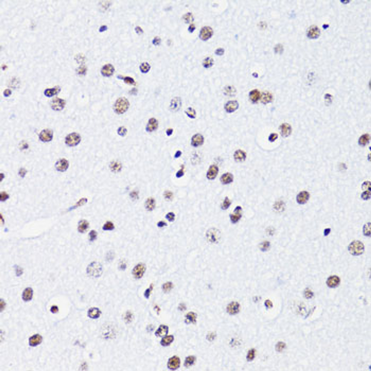 Immunohistochemistry of paraffin-embedded Mouse brain using Acetyl-Histone H2B-K15 Polyclonal Antibody at dilution of  1:100 (40x lens).