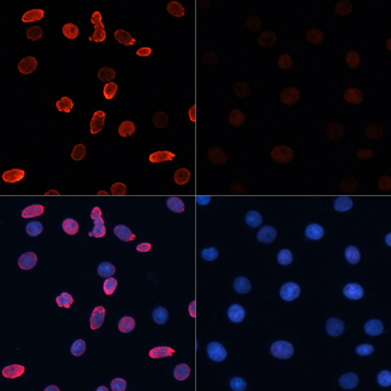 Immunofluorescence analysis of C6 cells using Acetyl-Histone H2B-K15 Polyclonal Antibody at dilution of  1:100.C6 cells were treated by TSA (1 uM) at 37℃ for 18 hours. Blue: DAPI for nuclear staining.