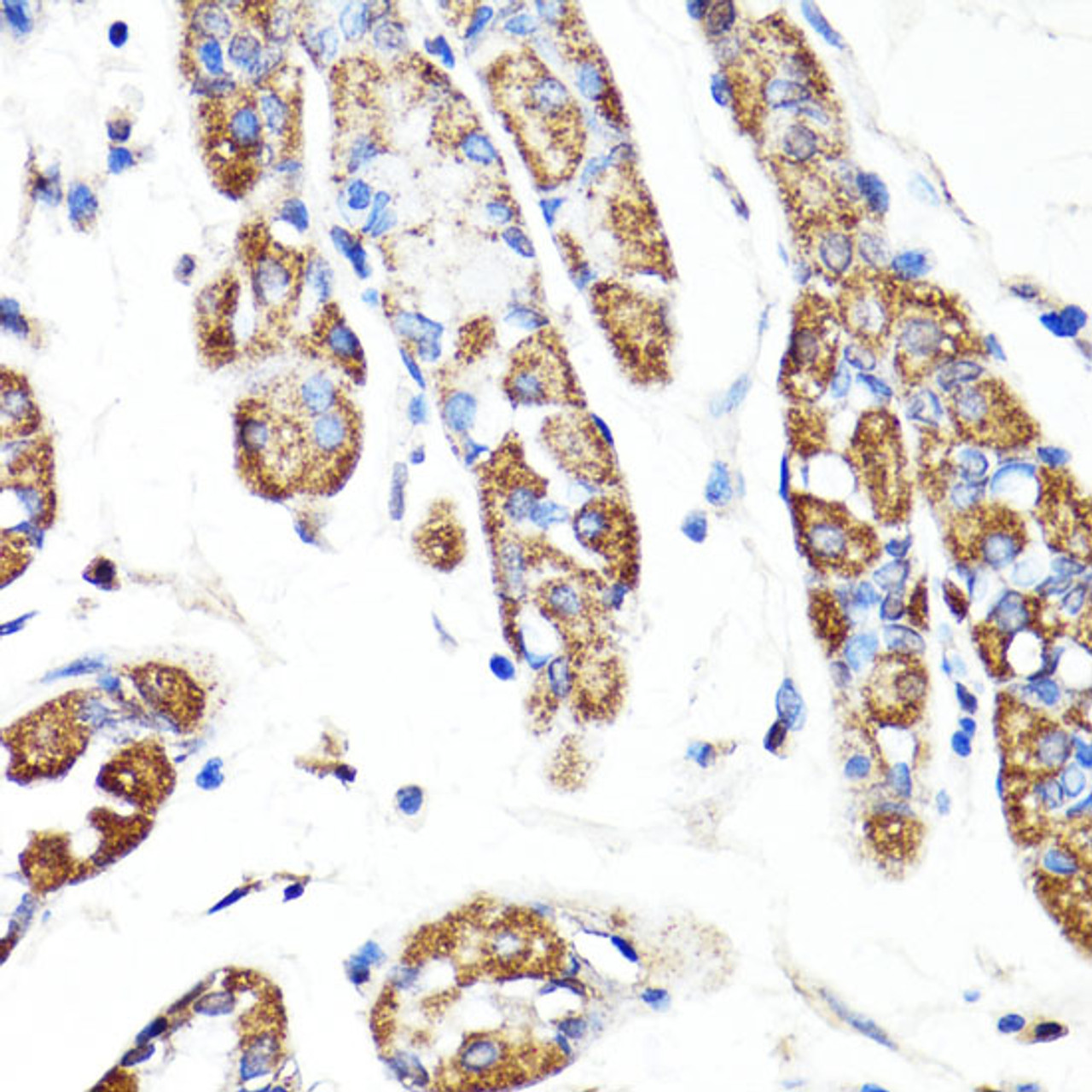 Immunohistochemistry of paraffin-embedded Human stomach using RNF149 Polyclonal Antibody at dilution of  1:100 (40x lens).