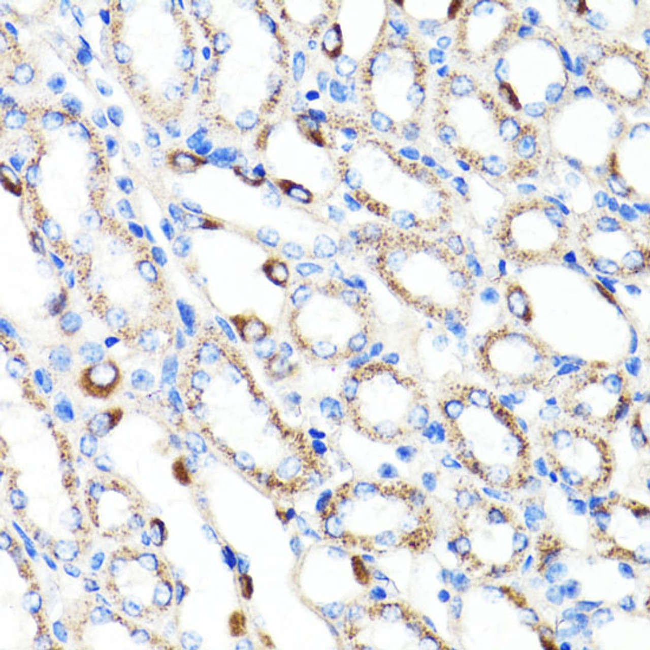 Immunohistochemistry of paraffin-embedded Mouse kidney using RNF149 Polyclonal Antibody at dilution of  1:100 (40x lens).