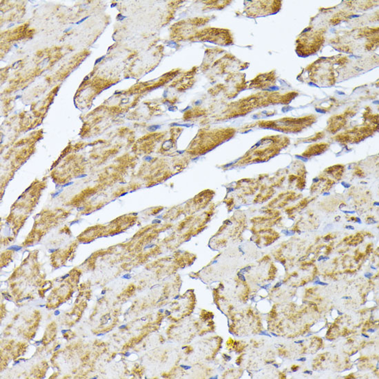 Immunohistochemistry of paraffin-embedded Mouse heart using SLC25A5 Polyclonal Antibody at dilution of  1:100 (40x lens).
