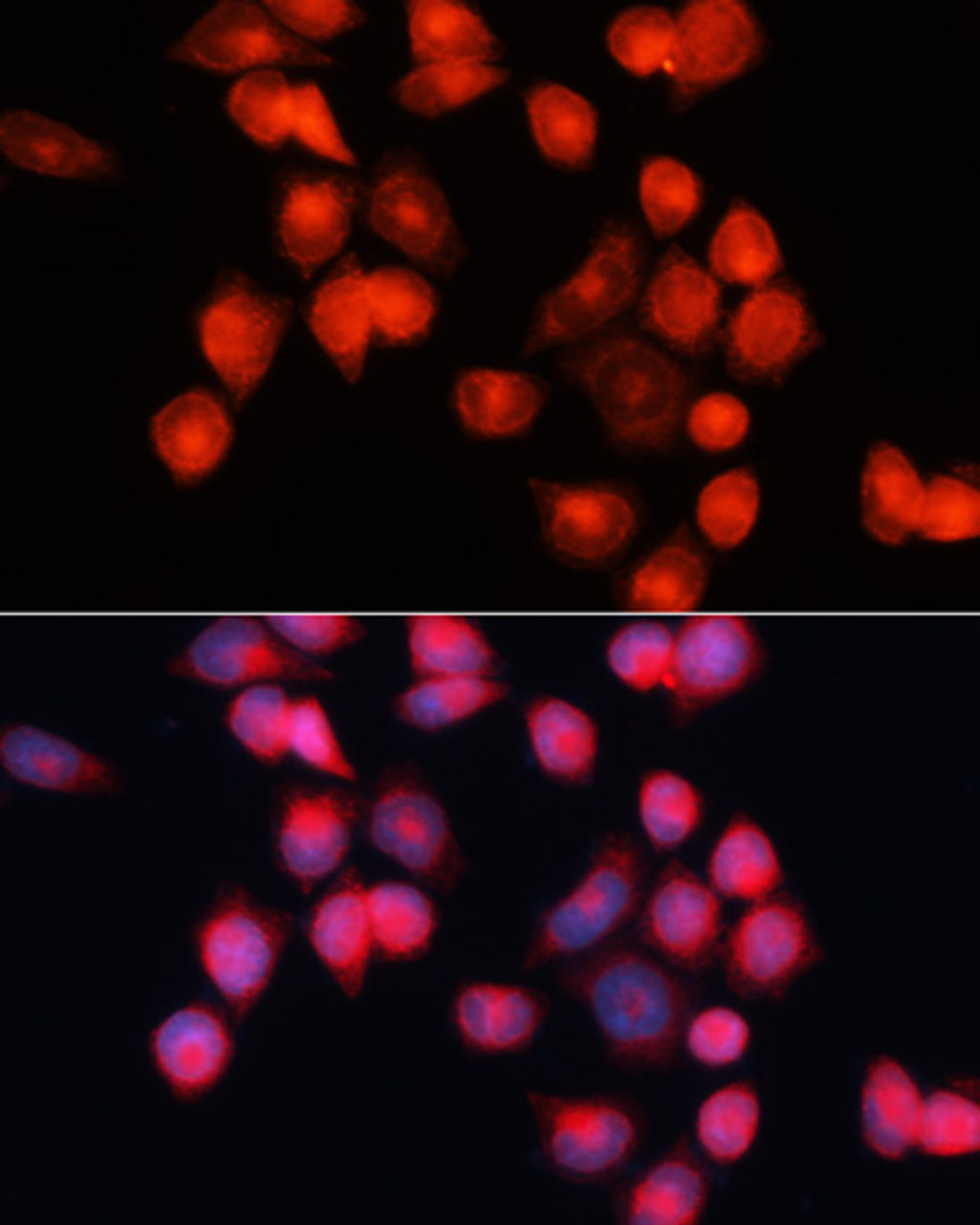 Immunofluorescence analysis of HeLa cells using SLC25A5 Polyclonal Antibody at dilution of  1:100 (40x lens). Blue: DAPI for nuclear staining.