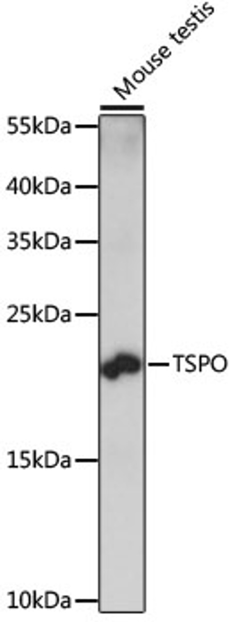 Western blot analysis of extracts of Mouse testis using TSPO Polyclonal Antibody at dilution of 1:1000.