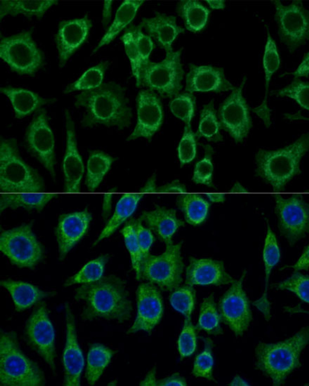 Immunofluorescence analysis of L929 cells using TSPO Polyclonal Antibody at dilution of  1:100 (40x lens). Blue: DAPI for nuclear staining.