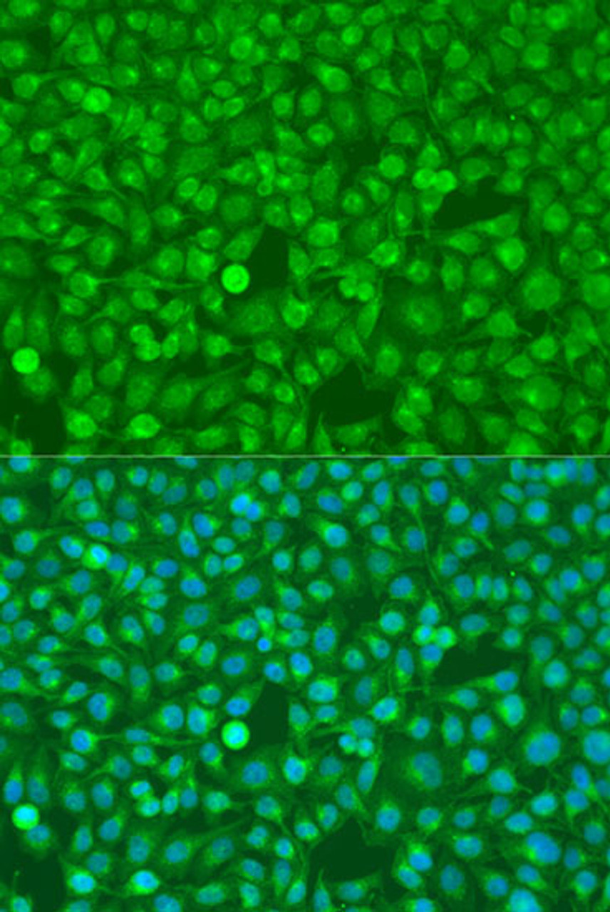 Immunofluorescence analysis of U2OS cells using CSF3 Polyclonal Antibody at dilution of  1:100. Blue: DAPI for nuclear staining.