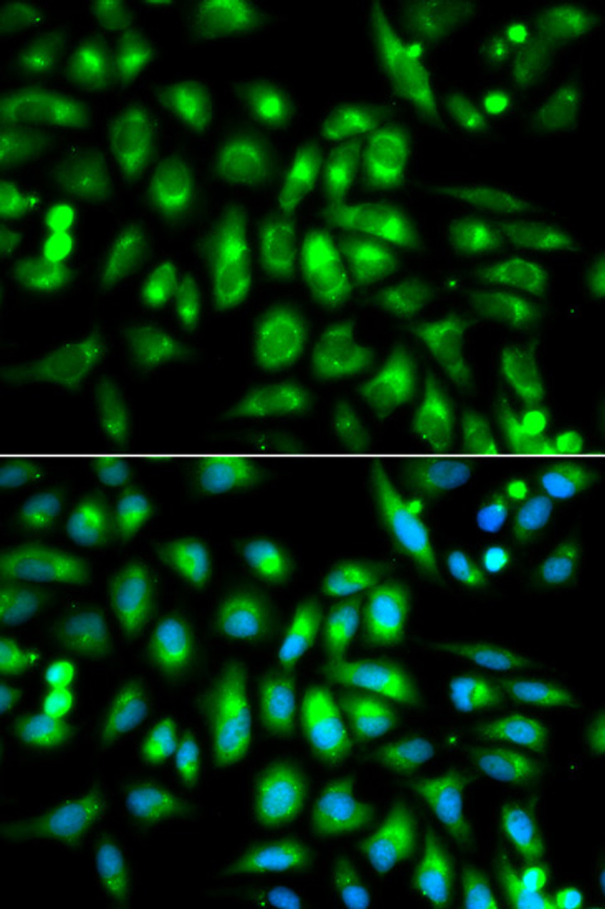 Immunofluorescence analysis of MCF-7 cells using CHRM2 Polyclonal Antibody