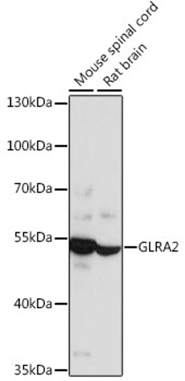 Western blot analysis of extracts of various cell lines using GLRA2 Polyclonal Antibody at dilution of 1:1000.