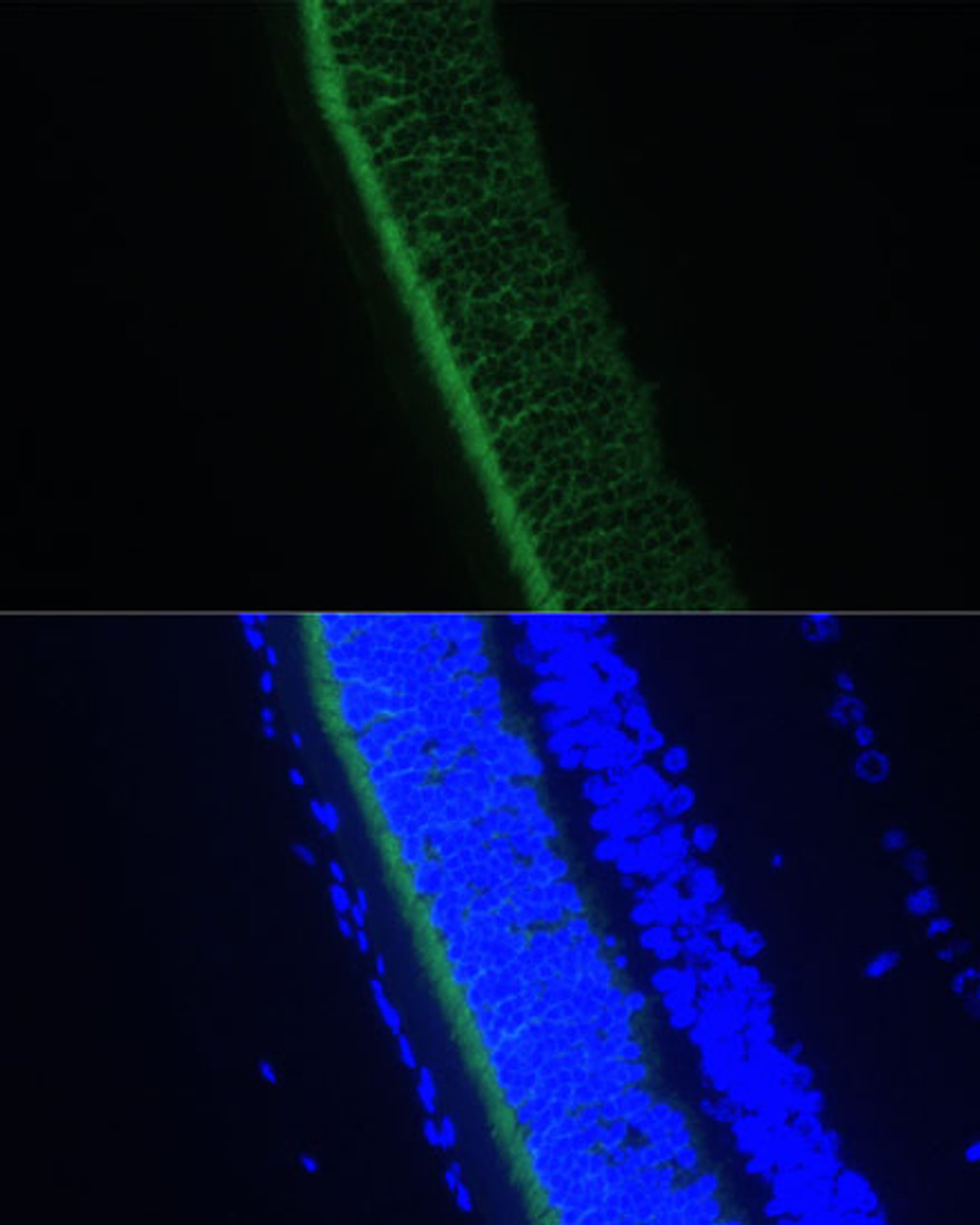 Immunofluorescence analysis of Rat eye using GNGT1 Polyclonal Antibody at dilution of  1:100 (40x lens). Blue: DAPI for nuclear staining.