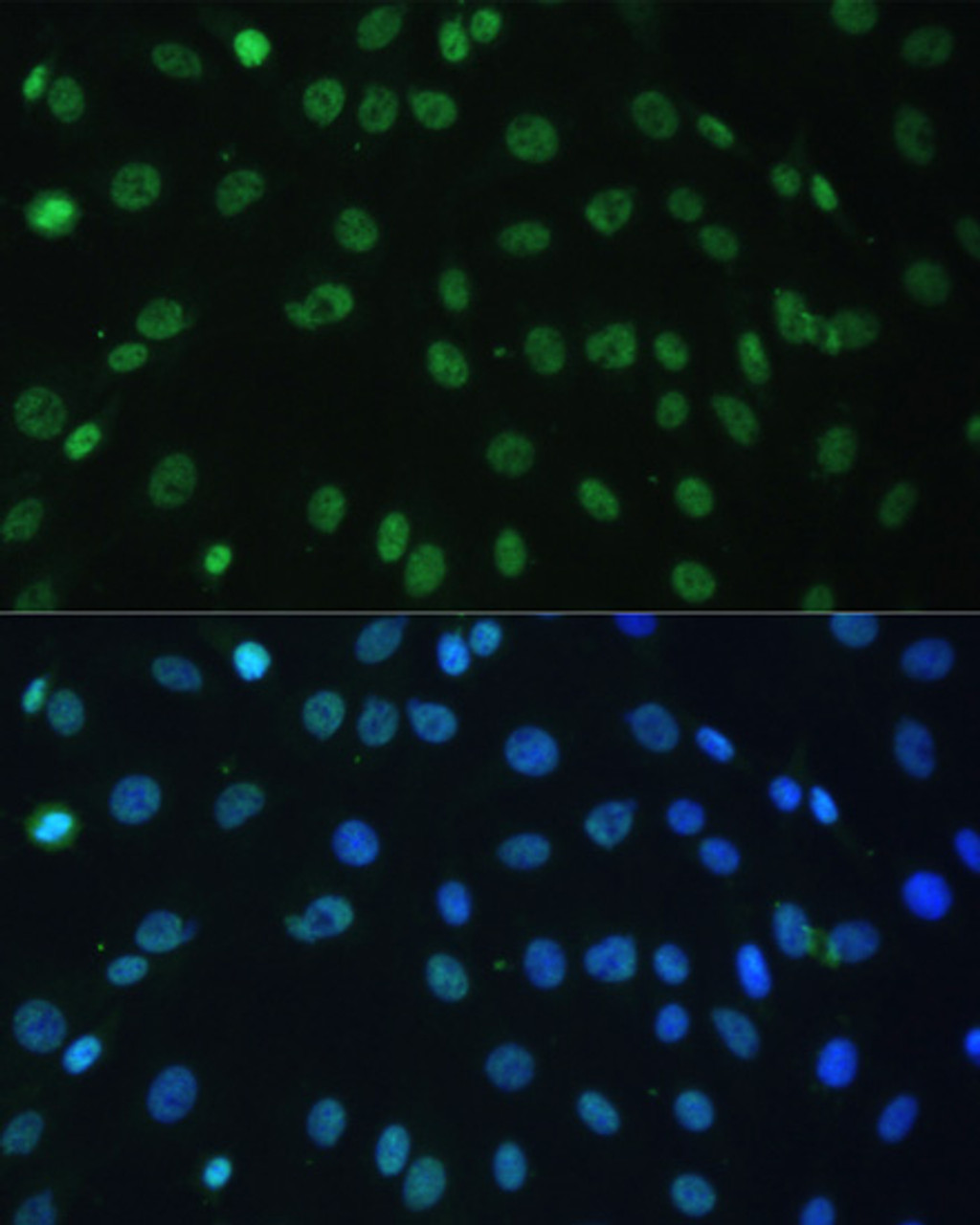 Immunofluorescence analysis of C6 cells using HNRNPD Polyclonal Antibody at dilution of  1:100. Blue: DAPI for nuclear staining.