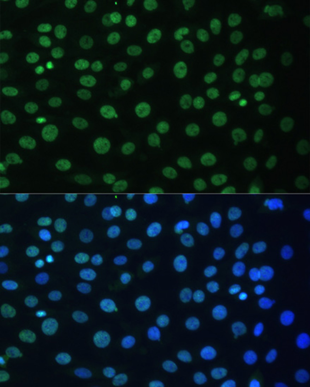 Immunofluorescence analysis of C6 cells using HNRNPD Polyclonal Antibody at dilution of  1:100. Blue: DAPI for nuclear staining.