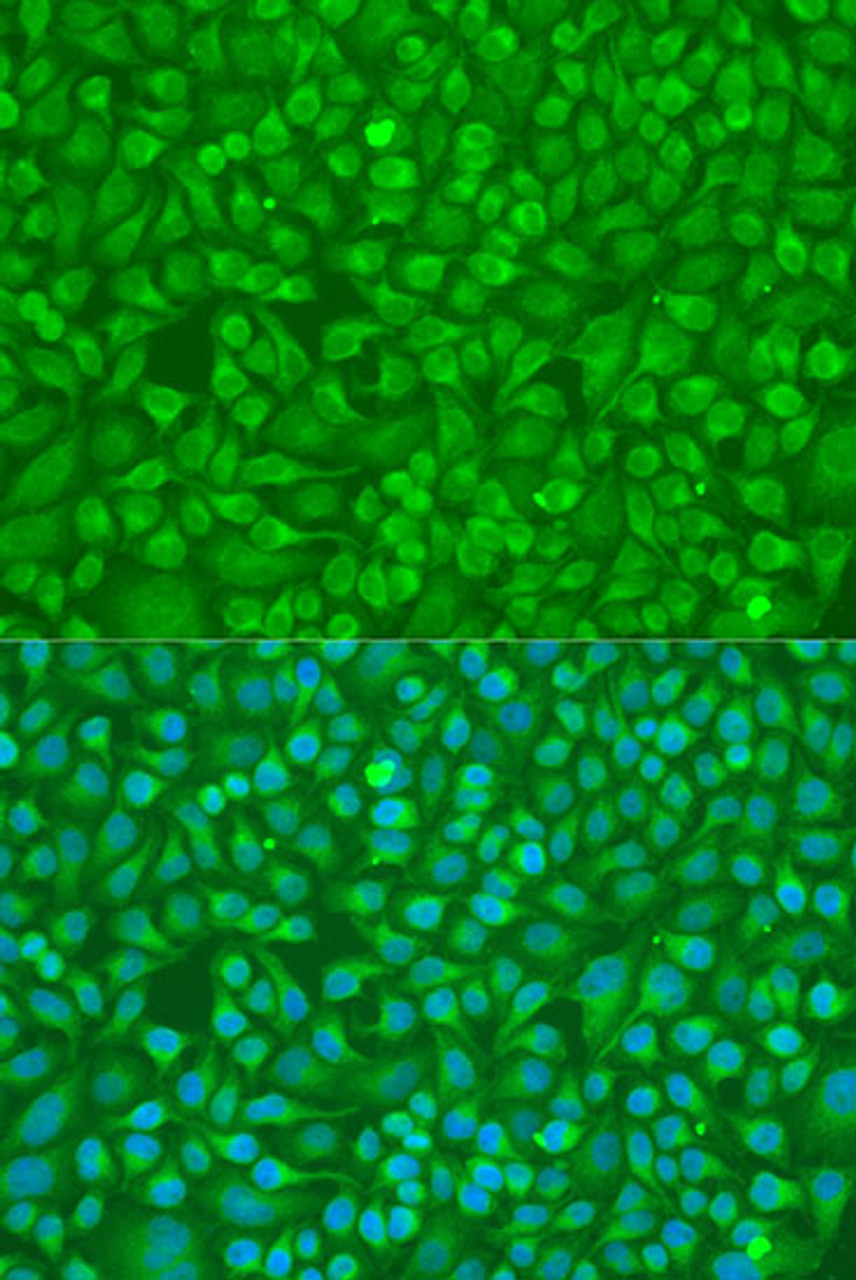 Immunofluorescence analysis of U2OS cells using PLCG1 Polyclonal Antibody at dilution of  1:100. Blue: DAPI for nuclear staining.