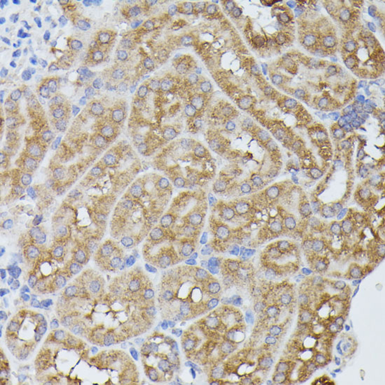 Immunohistochemistry of paraffin-embedded Mouse kidney using PPP2R5D Polyclonal Antibody at dilution of  1:100 (40x lens).