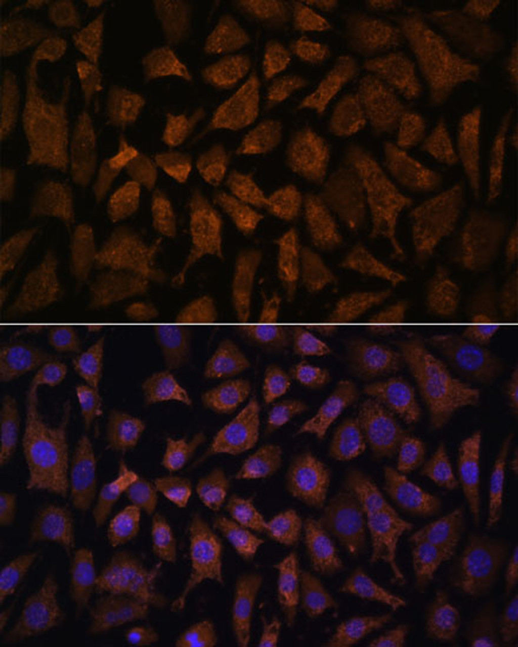Immunofluorescence analysis of L929 cells using PPP2R5D Polyclonal Antibody at dilution of  1:100. Blue: DAPI for nuclear staining.