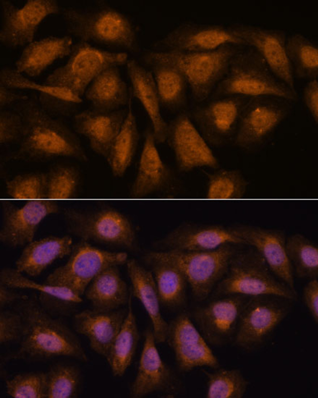 Immunofluorescence analysis of U-2 OS cells using PPP2R5D Polyclonal Antibody at dilution of  1:100. Blue: DAPI for nuclear staining.