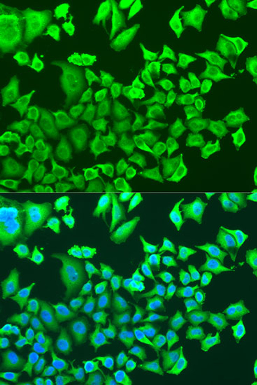 Immunofluorescence analysis of U2OS cells using PRKAB1 Polyclonal Antibody at dilution of  1:100. Blue: DAPI for nuclear staining.