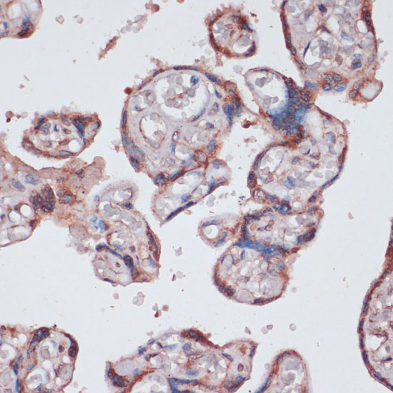 Immunohistochemistry of paraffin-embedded Human placenta using RPS13 Polyclonal Antibody at dilution of  1:100 (40x lens).