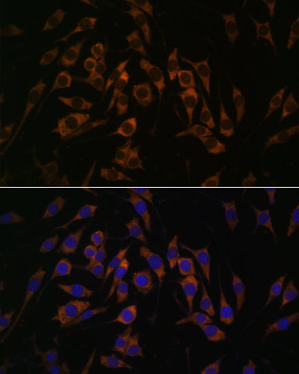Immunofluorescence analysis of L929 cells using RPS13 Polyclonal Antibody at dilution of  1:100. Blue: DAPI for nuclear staining.