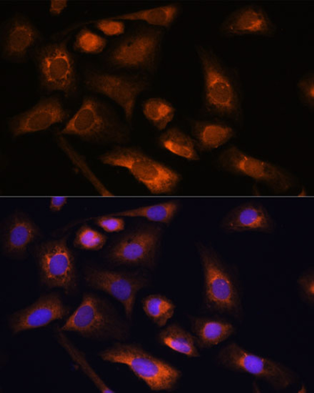 Immunofluorescence analysis of U-2 OS cells using RPS13 Polyclonal Antibody at dilution of  1:100. Blue: DAPI for nuclear staining.