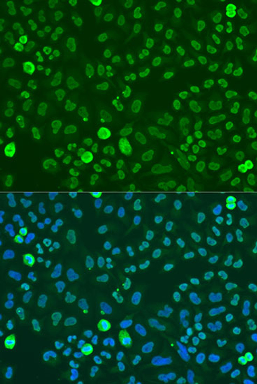 Immunofluorescence analysis of U2OS cells using SAFB Polyclonal Antibody at dilution of  1:100. Blue: DAPI for nuclear staining.