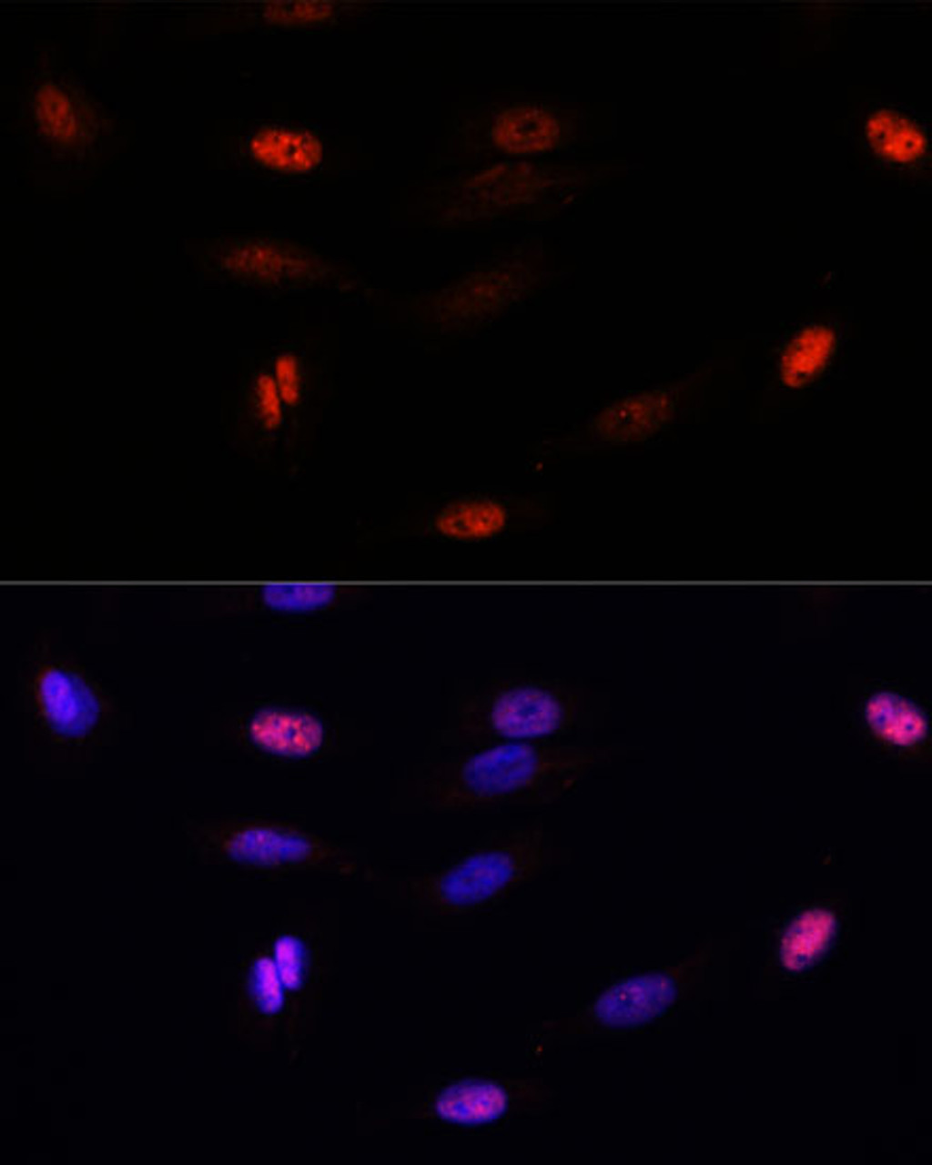 Immunofluorescence analysis of U-2 OS cells using SUMO3 Polyclonal Antibody at dilution of  1:100. Blue: DAPI for nuclear staining.