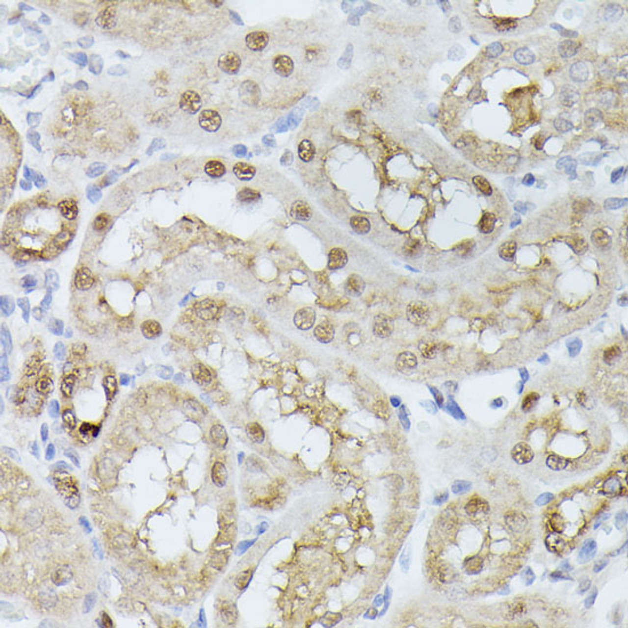 Immunohistochemistry of paraffin-embedded Rat kidney using TPI1 Polyclonal Antibody at dilution of  1:100 (40x lens).