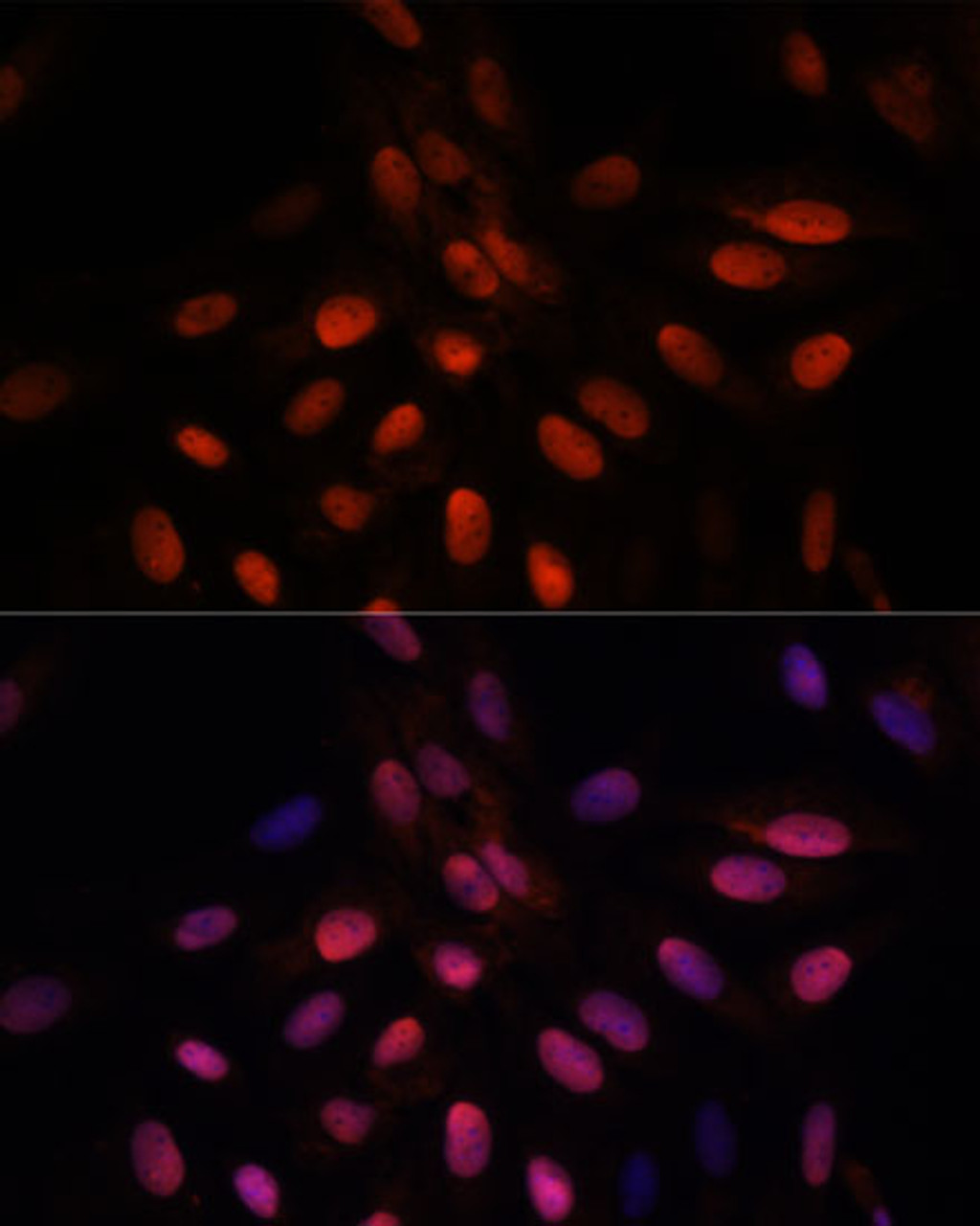 Immunofluorescence analysis of U-2 OS cells using TPI1 Polyclonal Antibody at dilution of  1:100. Blue: DAPI for nuclear staining.