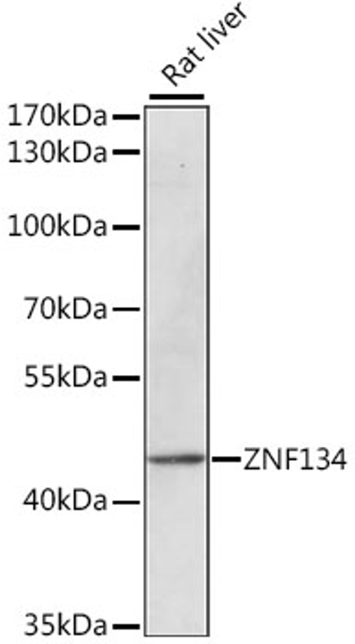 Western blot analysis of extracts of Rat liver using ZNF134 Polyclonal Antibody at dilution of 1:1000.