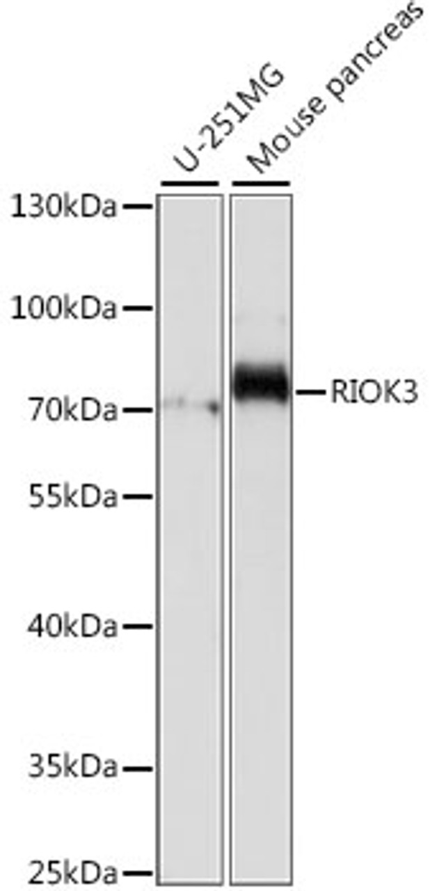 Western blot analysis of extracts of various cell lines using RIOK3 Polyclonal Antibody at dilution of 1:1000.