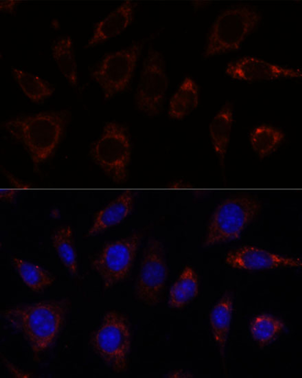 Immunofluorescence analysis of L929 cells using TBRG4 Polyclonal Antibody at dilution of  1:100. Blue: DAPI for nuclear staining.