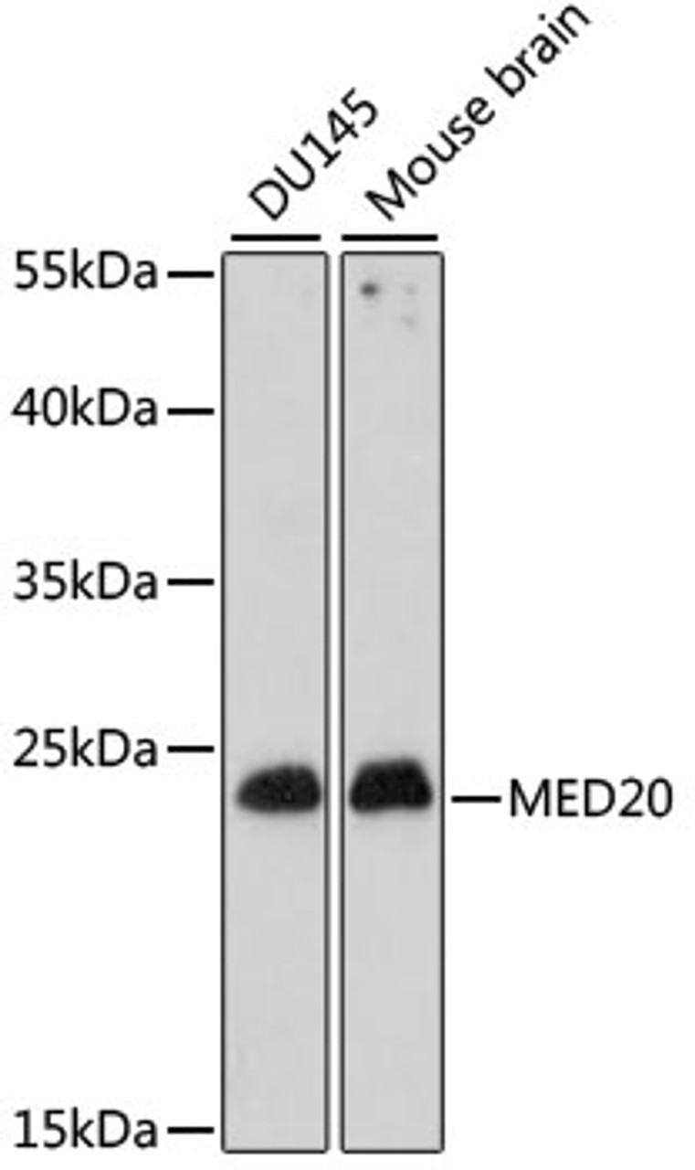 Western blot analysis of extracts of various cell lines using MED20 Polyclonal Antibody at dilution of 1:1000.