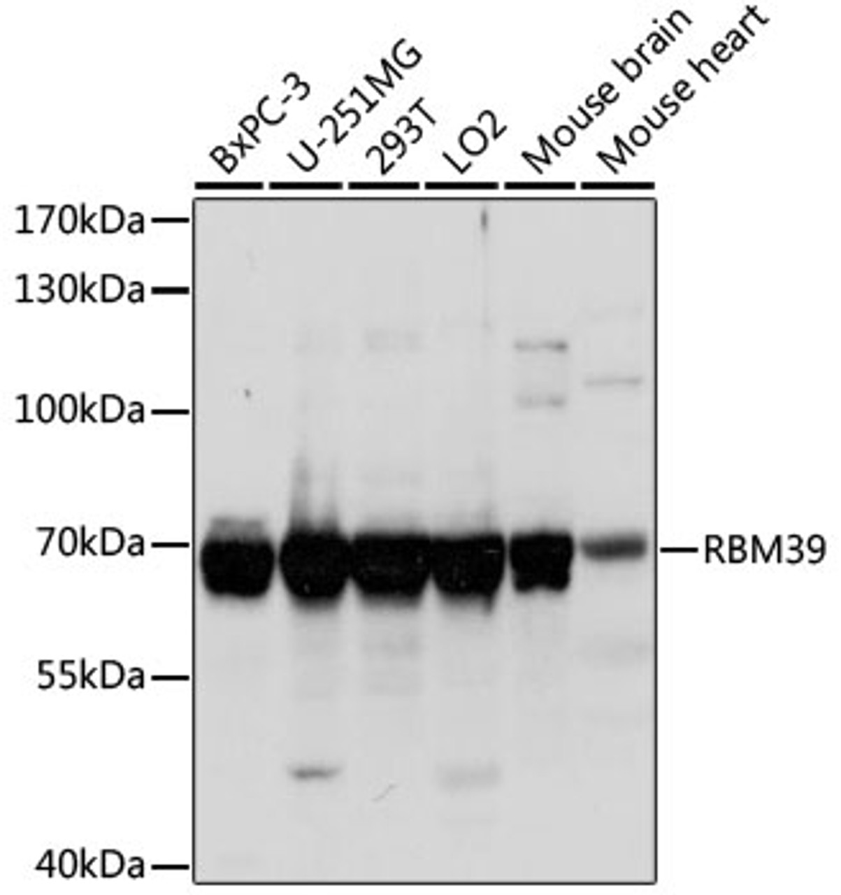 Western blot analysis of extracts of various cell lines using RBM39 Polyclonal Antibody at dilution of 1:1000.