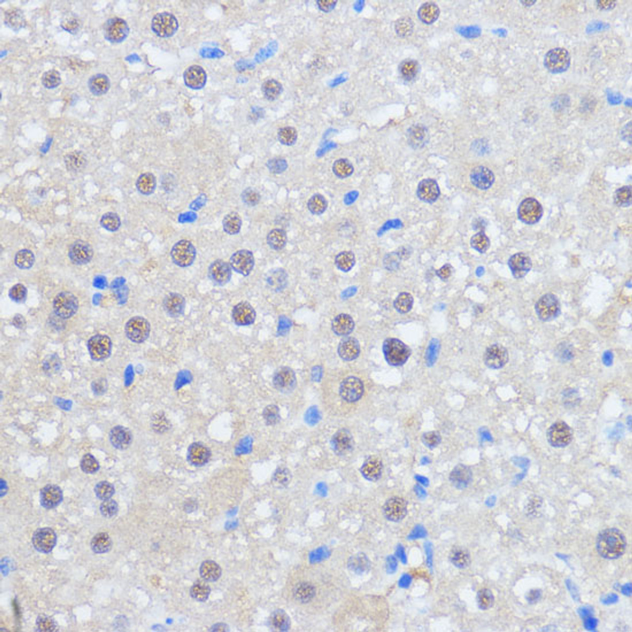 Immunohistochemistry of paraffin-embedded Rat liver using RBM39 Polyclonal Antibody at dilution of  1:100 (40x lens).