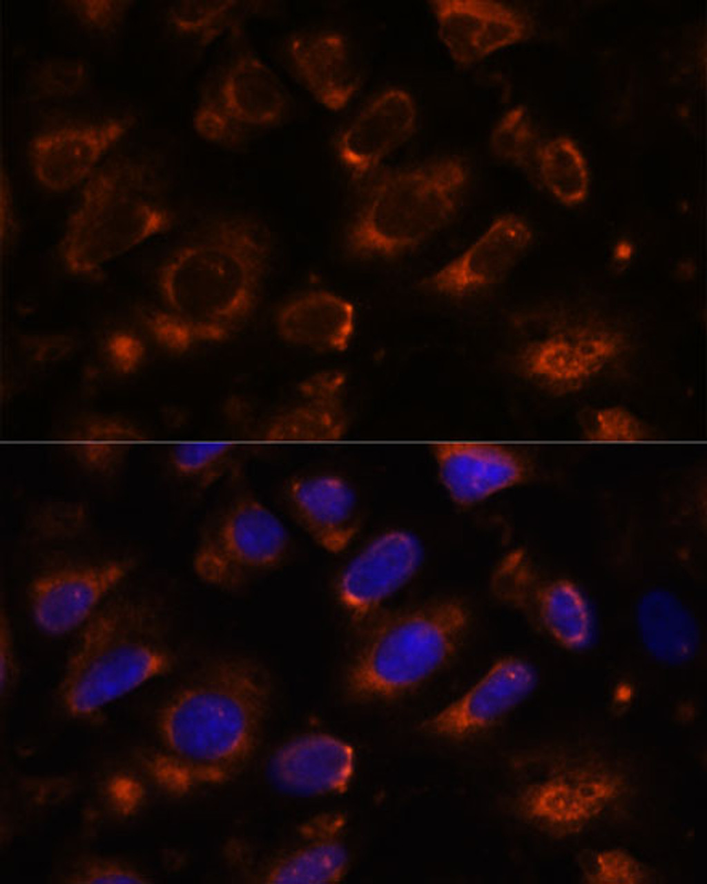 Immunofluorescence analysis of U-2 OS cells using TENM1 Polyclonal Antibody at dilution of  1:100. Blue: DAPI for nuclear staining.