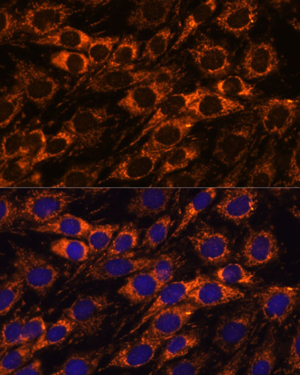 Immunofluorescence analysis of C6 cells using ACAA2 Polyclonal Antibody at dilution of  1:100. Blue: DAPI for nuclear staining.