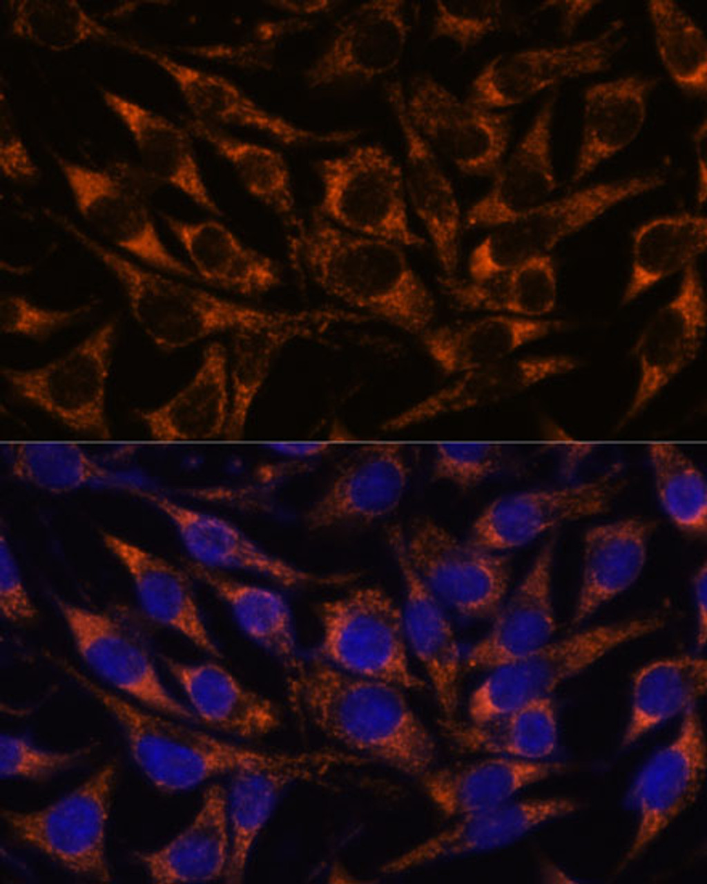 Immunofluorescence analysis of L929 cells using ACAA2 Polyclonal Antibody at dilution of  1:100. Blue: DAPI for nuclear staining.