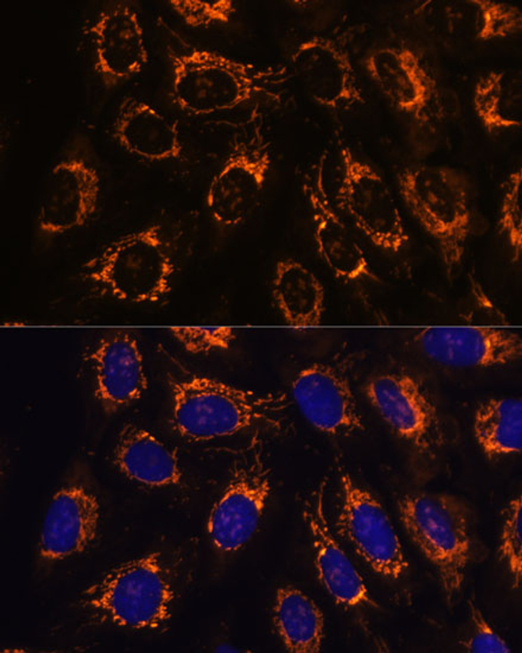 Immunofluorescence analysis of U-2 OS cells using ACAA2 Polyclonal Antibody at dilution of  1:100. Blue: DAPI for nuclear staining.