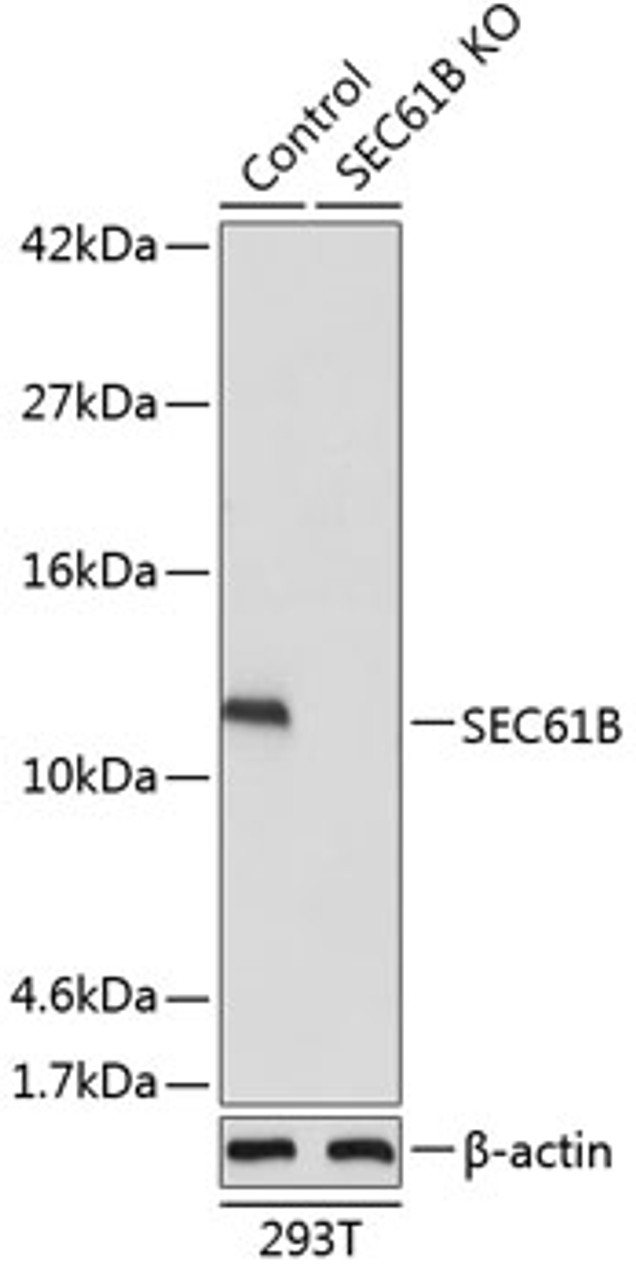 Western blot analysis of extracts from normal (control) and SEC61B knockout (KO) 293T cells using SEC61B Polyclonal Antibody at dilution of 1:1000.