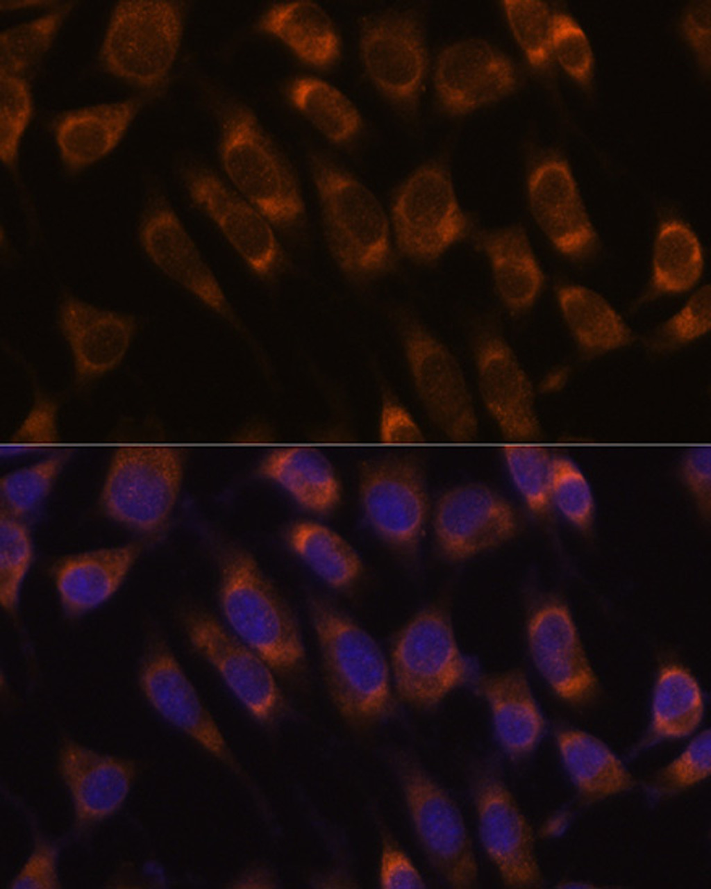 Immunofluorescence analysis of L929 cells using SEC61B Polyclonal Antibody at dilution of  1:100. Blue: DAPI for nuclear staining.