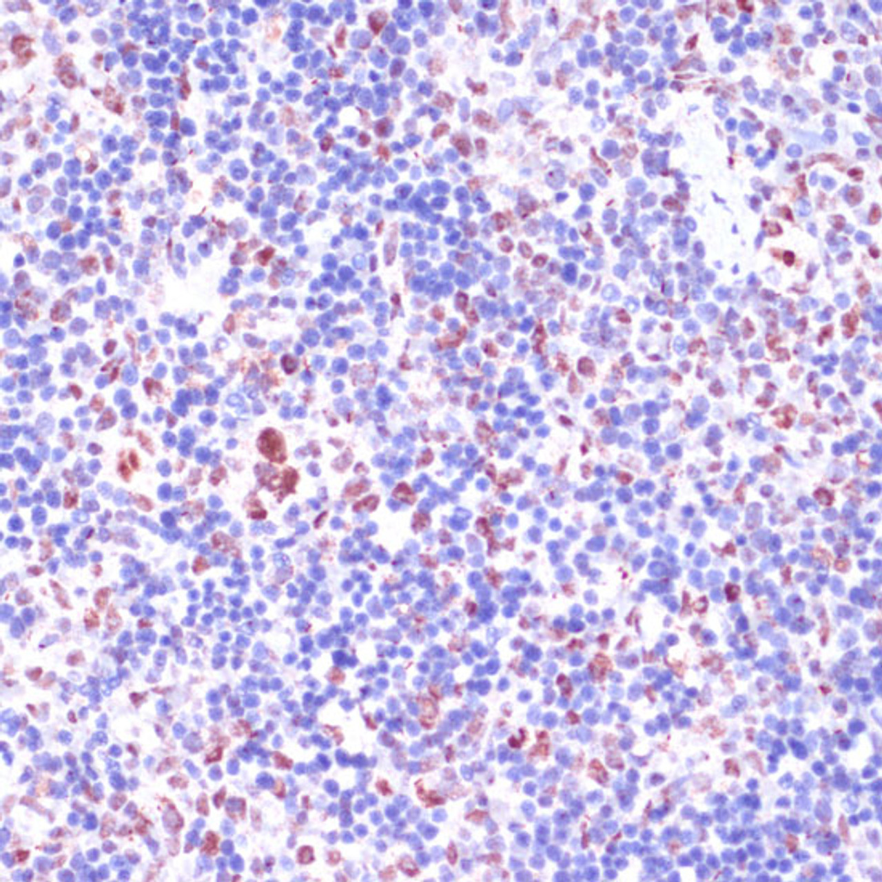 Immunohistochemistry of paraffin-embedded Rat spleen using KDM1 Polyclonal Antibody at dilution of  1:100 (40x lens).