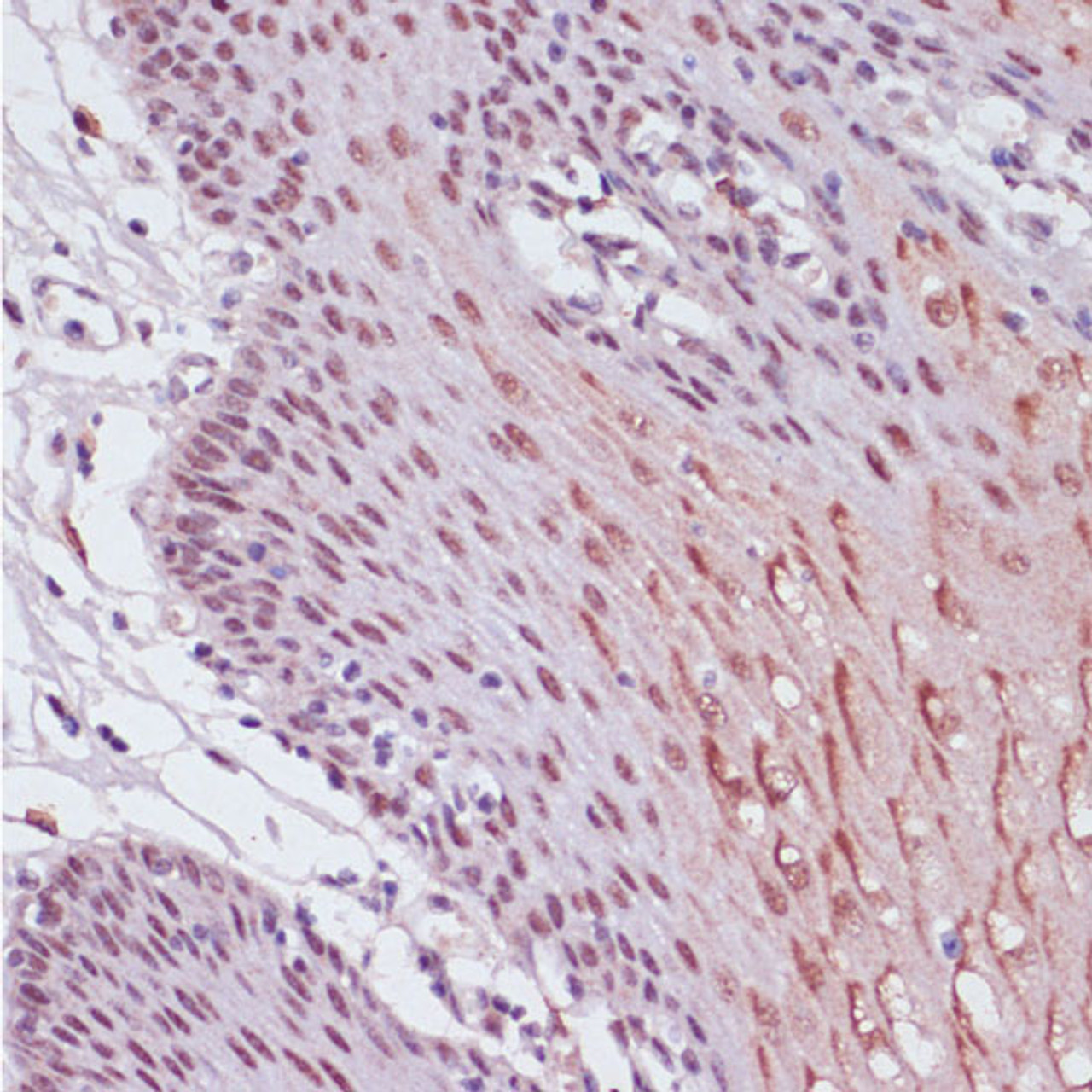 Immunohistochemistry of paraffin-embedded Human esophageal using KDM1 Polyclonal Antibody at dilution of  1:100 (40x lens).
