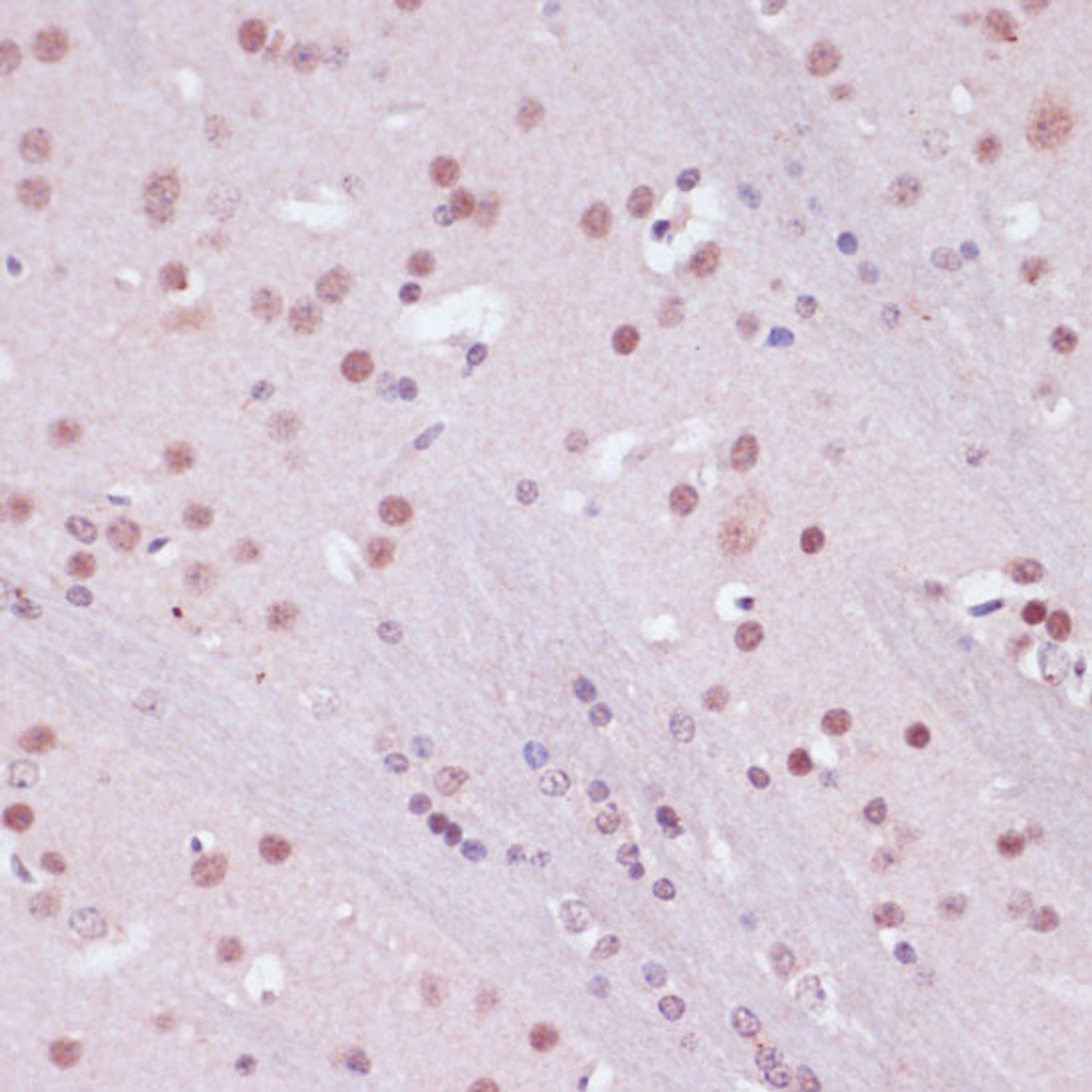 Immunohistochemistry of paraffin-embedded Mouse brain using KDM1 Polyclonal Antibody at dilution of  1:100 (40x lens).