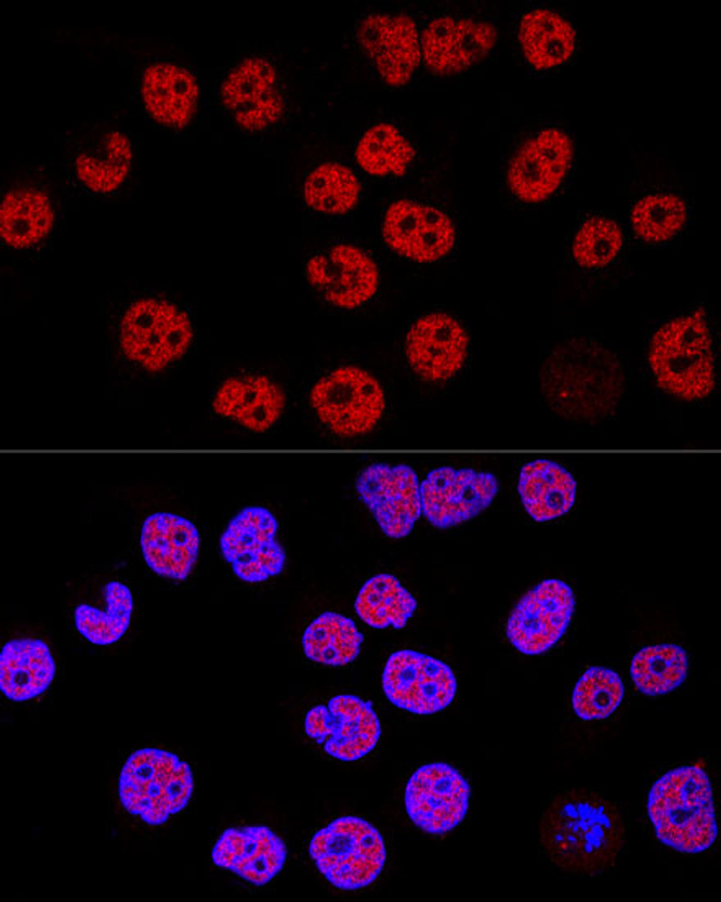 Confocal immunofluorescence analysis of Hela cells using KDM1 Polyclonal Antibody at dilution of  1:200. Blue: DAPI for nuclear staining.