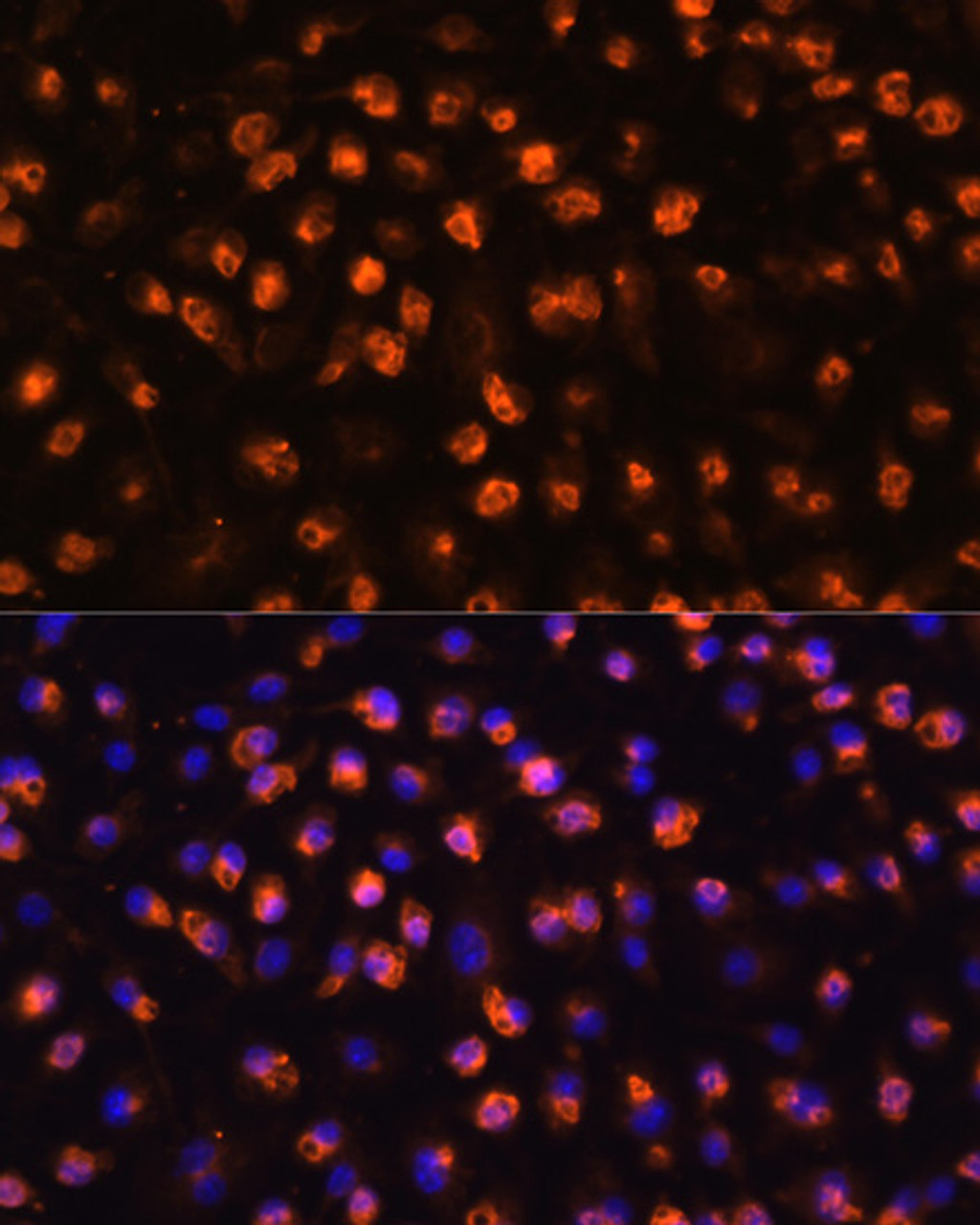 Immunofluorescence analysis of RAW264.7 cells using CD11B Polyclonal Antibody at dilution of  1:100. Blue: DAPI for nuclear staining.