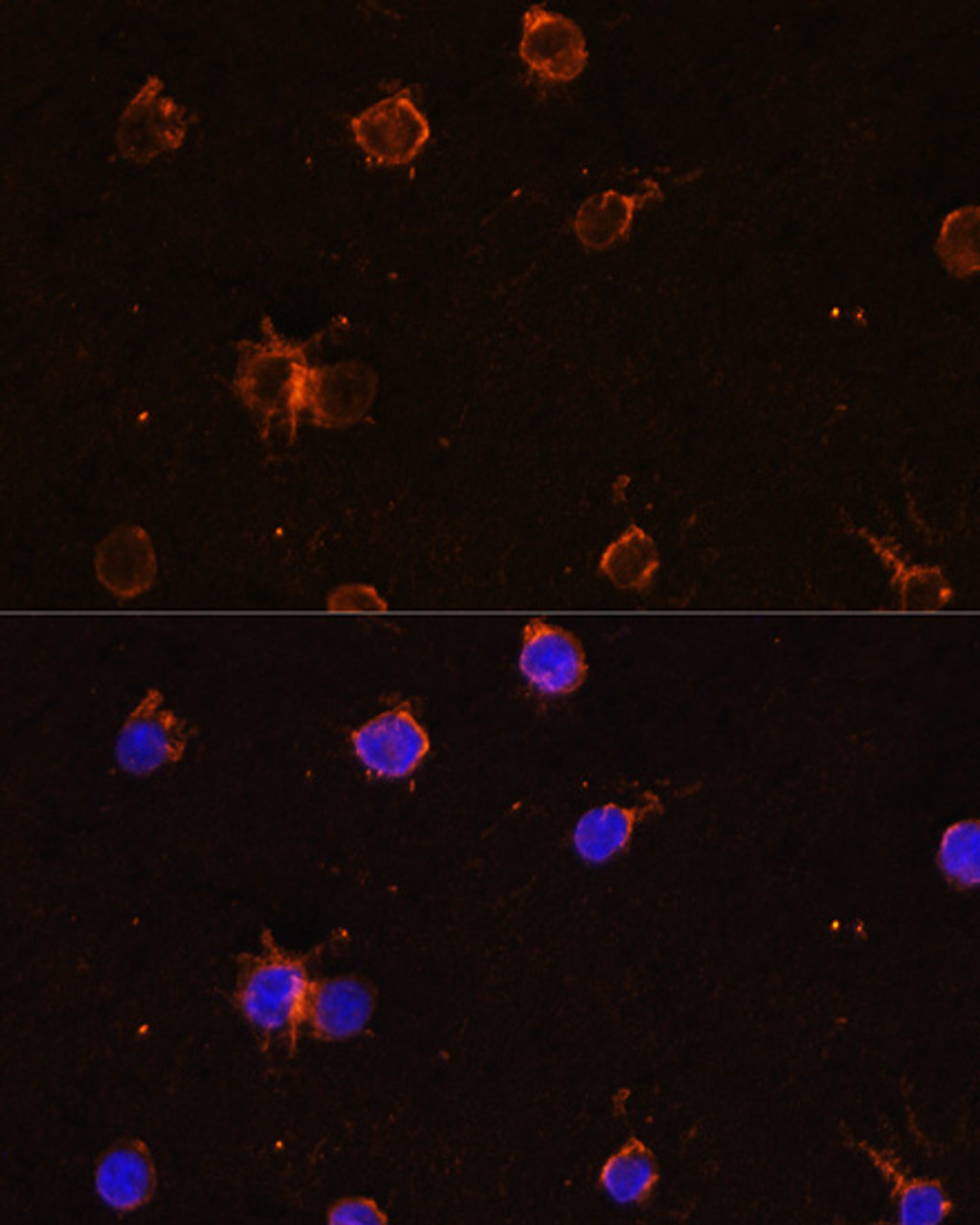 Immunofluorescence analysis of THP-1 cells using CD11B Polyclonal Antibody at dilution of  1:100. Blue: DAPI for nuclear staining.