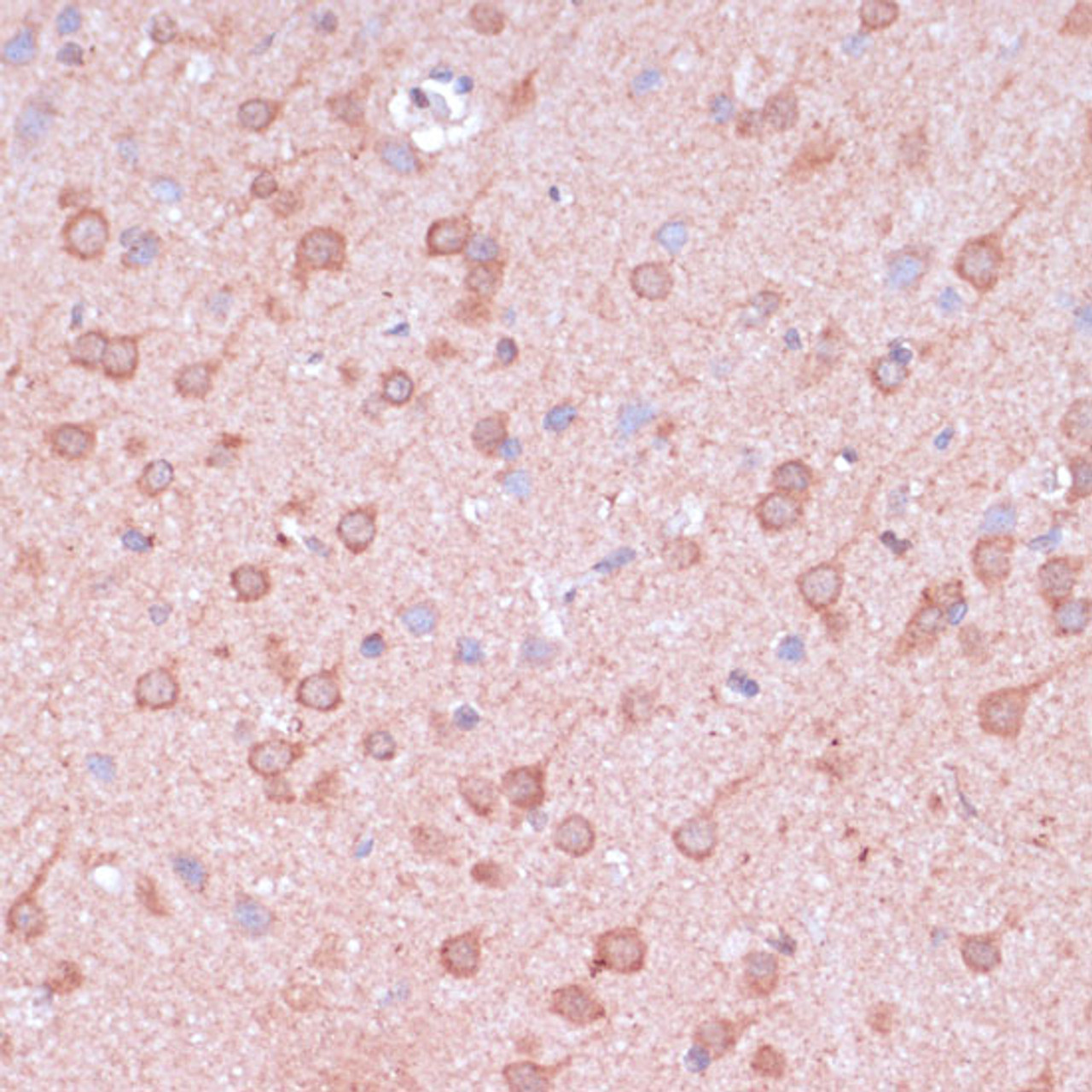 Immunohistochemistry of paraffin-embedded Rat brain using TIMM8B Polyclonal Antibody at dilution of  1:100 (40x lens).