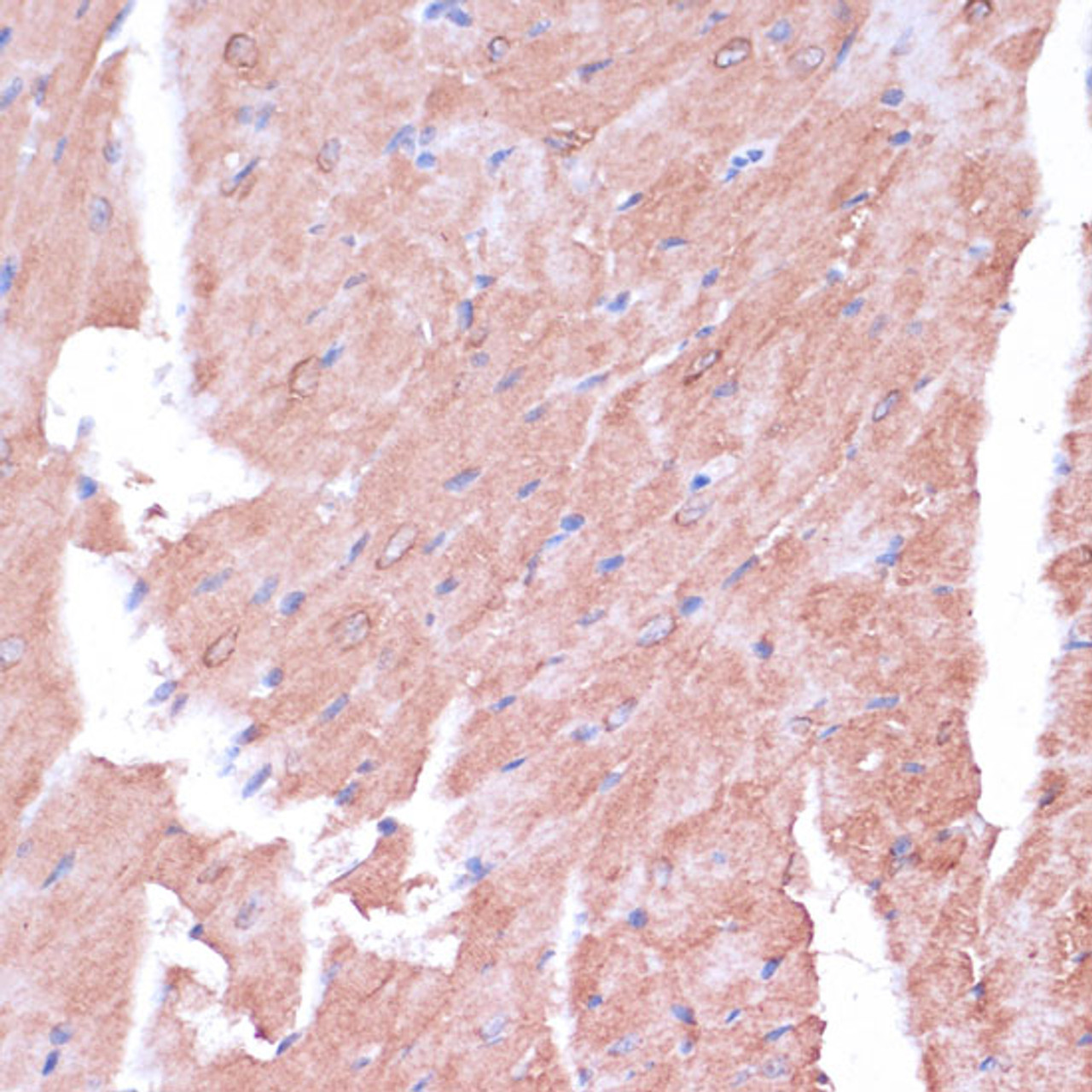 Immunohistochemistry of paraffin-embedded Mouse heart using TIMM8B Polyclonal Antibody at dilution of  1:100 (40x lens).