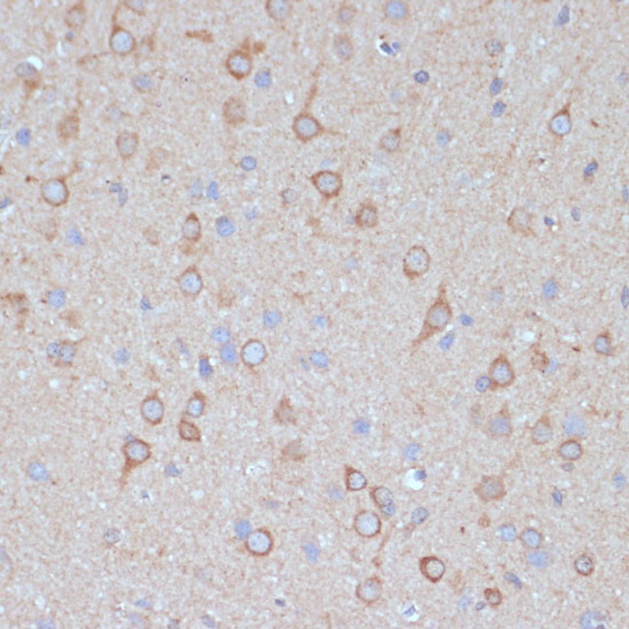 Immunohistochemistry of paraffin-embedded Rat brain using COPG2 Polyclonal Antibody at dilution of  1:100 (40x lens).